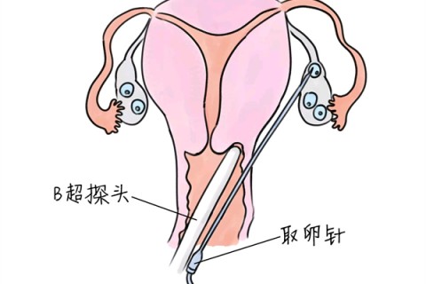 http://haerbin.huochezhan.net/post/205.html|哈尔滨供卵助孕