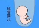 培养哈尔滨捐卵宝宝艺术细胞的小技巧